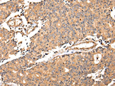 CSB-PA090286