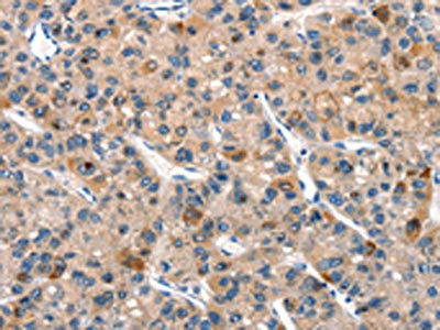 CSB-PA094054