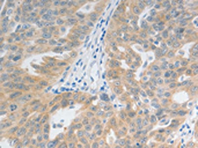 CSB-PA125699