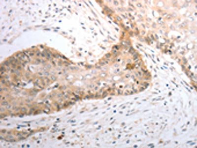 CSB-PA281969