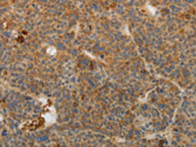 CSB-PA592707