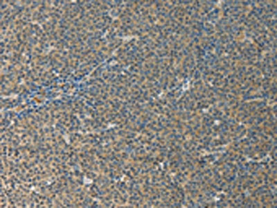 CSB-PA592707