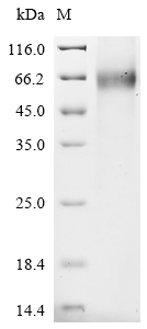 CSB-BP883618HU
