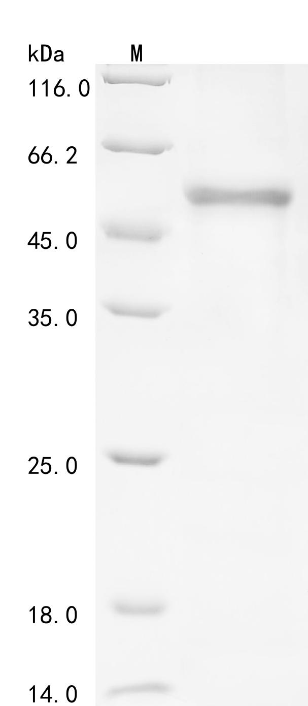 CSB-EP005899HU
