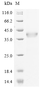 CSB-EP011876HU