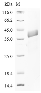 CSB-EP019144HU1