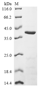 CSB-EP355776HU