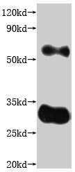 CSB-MP005498HU(A5)