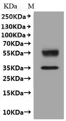 CSB-MP006256HU