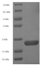 CSB-EP001964HU