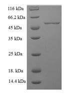 CSB-EP013752HU