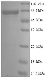CSB-EP017408HU