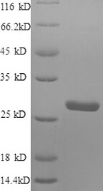 CSB-EP020632HU