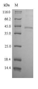 CSB-EP007717HU