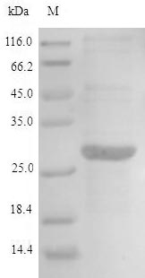 CSB-EP618761HU