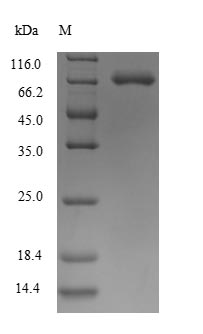 CSB-YP021000HU
